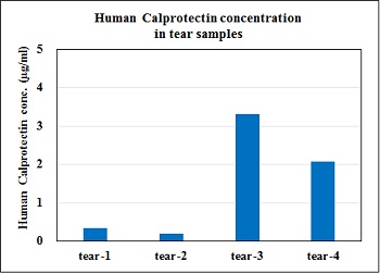Human calprotectin concentration in tear samples from healthy volunteers